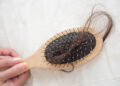 masalah rambut gugur