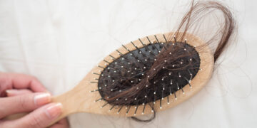 masalah rambut gugur