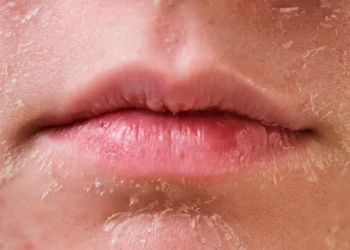 Krim Pelembap Terbaik untuk Kulit Kering di Malaysia