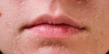 Krim Pelembap Terbaik untuk Kulit Kering di Malaysia