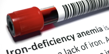 Feeling Weak? It Could Be Low Iron