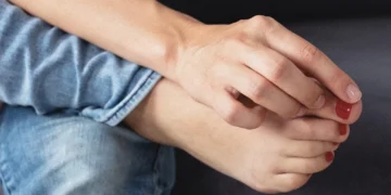 Masalah Kuku Kaki: Ramai Malu, Tapi Ramai Yang Alami