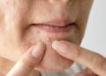 Skin Breakout Waktu Period? Ini Hidden Message dari Kitaran Haid! 