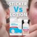 The Truth About Pimple Patches vs Acne Drying Lotion
