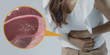 Orang Dewasa Pun Boleh Ada Jangkitan Cacing – Ini Tanda-Tandanya!