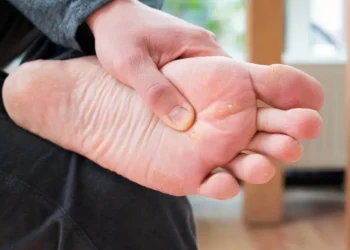 Gatal, Sakit & Hodoh! Ketuat Kaki Boleh Dirawat – Ini Caranya!