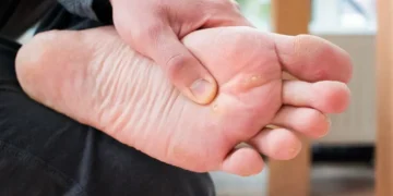 Gatal, Sakit & Hodoh! Ketuat Kaki Boleh Dirawat – Ini Caranya!