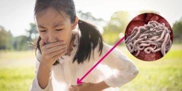 Ibu Bapa Wajib Tahu: Tanda-Tanda Anak Dijangkiti Cacing
