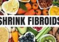 Say Goodbye to Fibroid Naturally : Cuba 10 Makanan Ini