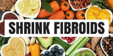 Say Goodbye to Fibroid Naturally : Cuba 10 Makanan Ini