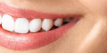 Sakit & Luka di Tepi Bibir? Mungkin Anda Alami Angular Cheilitis