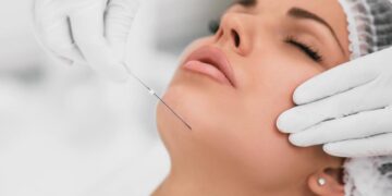 Tanam Benang: Rawatan Muka Moden yang Makin Popular!