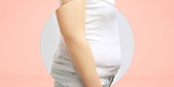 Perut Buncit Tapi Bukan Lemak – Mungkinkah Fibroid?