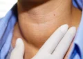 Hypothyroid: Simptom, Punca dan Cara Mengatasi