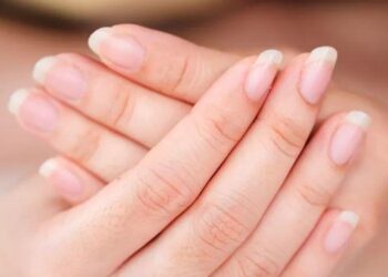 Apa Keadaan Kuku Anda Dedahkan Tentang Kesihatan Dalaman?