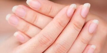 Apa Keadaan Kuku Anda Dedahkan Tentang Kesihatan Dalaman?