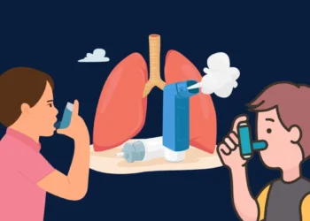 Ketahui Jenis-Jenis Asma & Cara Menguruskannya