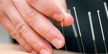 Akupuntur: Rawatan Tradisional, Keputusan Moden