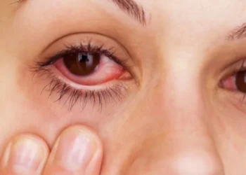 Sakit Mata Berjangkit? Ini Cara Kenal Pasti & Rawat Konjunktivitis