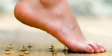 7 Petua Mudah Hilangkan Sakit Tumit Secara Semula Jadi