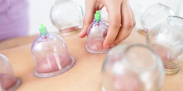 Manfaat Bekam: Rawatan Tradisional Untuk Tenaga Lebih Optimal