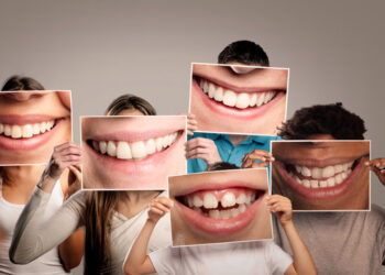 Gigitan Silang (Crossbite) Boleh Pengaruhi Senyuman & Kesihatan Mulut Anda!