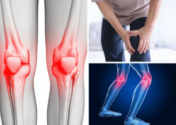 Cara Semulajadi Kurangkan Sakit Sendi untuk Kembali Aktif Bergerak