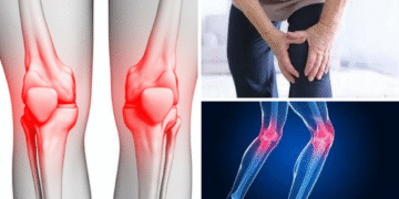 Cara Semulajadi Kurangkan Sakit Sendi untuk Kembali Aktif Bergerak