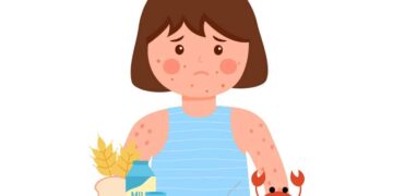 Mengenali Simptom Alahan Makanan dalam Kalangan Kanak-Kanak