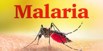 Mengapa Malaria Masih Jadi Ancaman? Punca, Simptom & Cara Cegah