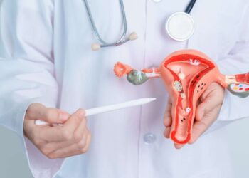 PCOS Bukan Sekadar Masalah Haid – Fahami Kesan Jangka Panjangnya