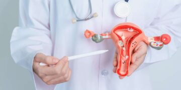 PCOS Bukan Sekadar Masalah Haid – Fahami Kesan Jangka Panjangnya