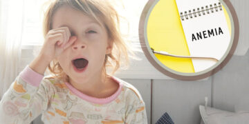 Anemia dalam Kalangan Kanak-Kanak: Punca, Simptom dan Rawatan