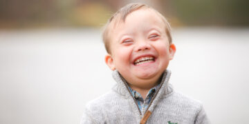 Sindrom Down: Fakta, Simptom & Tips Sokongan Untuk Keluarga