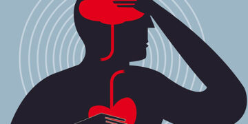 Cara Elakkan Strok Secara Semulajadi: Tip Sihat Lindungi Otak