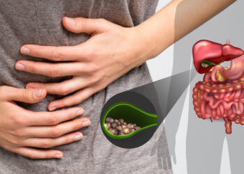 Batu Karang: Tanda Awal, Rawatan & Cara Mencegahnya