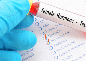7 Ujian Hormon Wanita Penting untuk Kesihatan Reproduktif & Umum