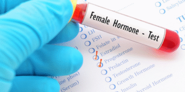 7 Ujian Hormon Wanita Penting untuk Kesihatan Reproduktif & Umum