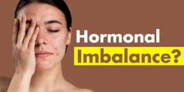 Tanda Hormon Tidak Seimbang: Kenali Simptom Awal Sebelum Terlambat