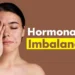 Tanda Hormon Tidak Seimbang: Kenali Simptom Awal Sebelum Terlambat