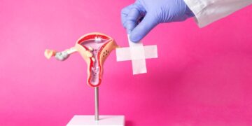 Punca Cyst dan Fibroid: Kenapa Semakin Ramai Wanita Alaminya?