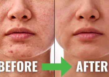 Serum Niacinamide: Rahsia Kulit Cerah, Licin & Bebas Cela