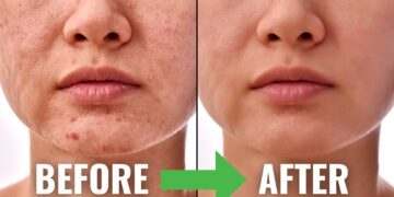 Serum Niacinamide: Rahsia Kulit Cerah, Licin & Bebas Cela