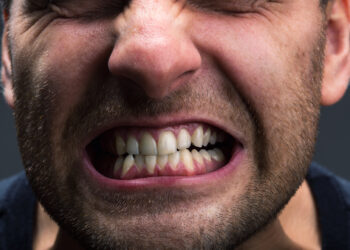 Bruxism: Tabiat Gesel Gigi Waktu Tidur Jejas Kesihatan Mulut