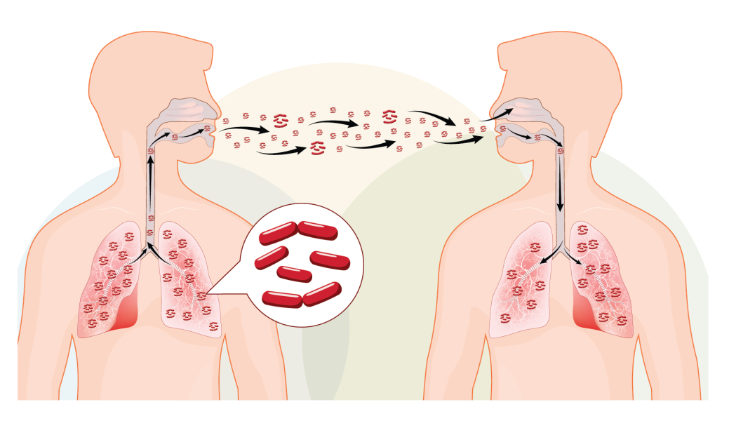jangkitan pernafasan