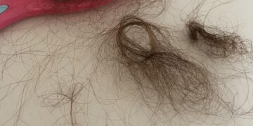 What Vitamins Should I Take For Hair Loss?