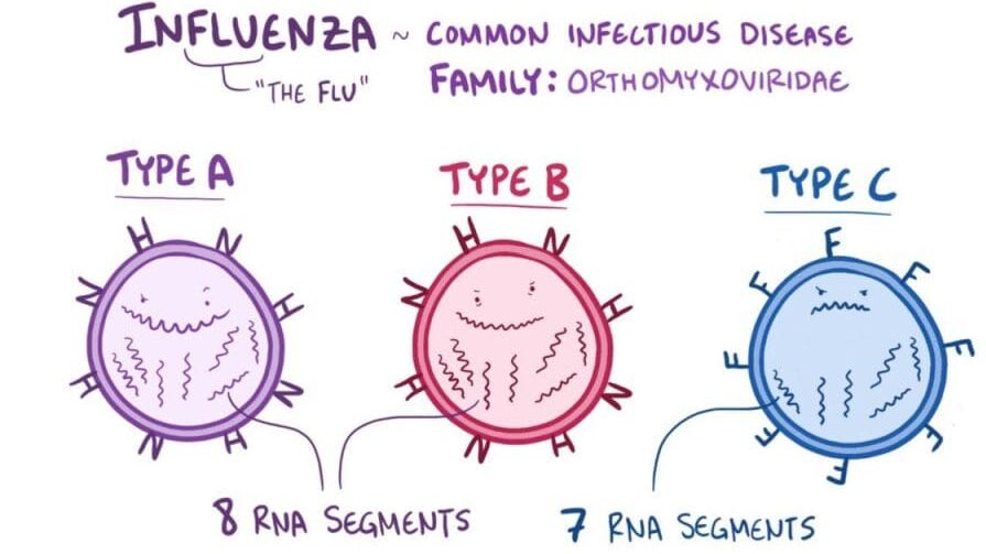 influenza