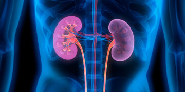 5 Things You Need To Know About Kidney Failure