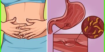What Are The Natural Remedies For Intestinal Worms?