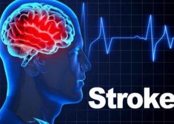 Tanda-Tanda Awal Strok: Kenali Simptom Sebelum Terlambat, F.A.S.T